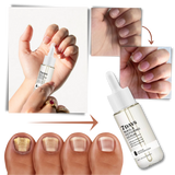 7 Days Nail Repair Essence