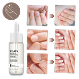 7 Days Nail Repair Essence