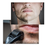 Dermal Roller For Hair And Beard Growth
